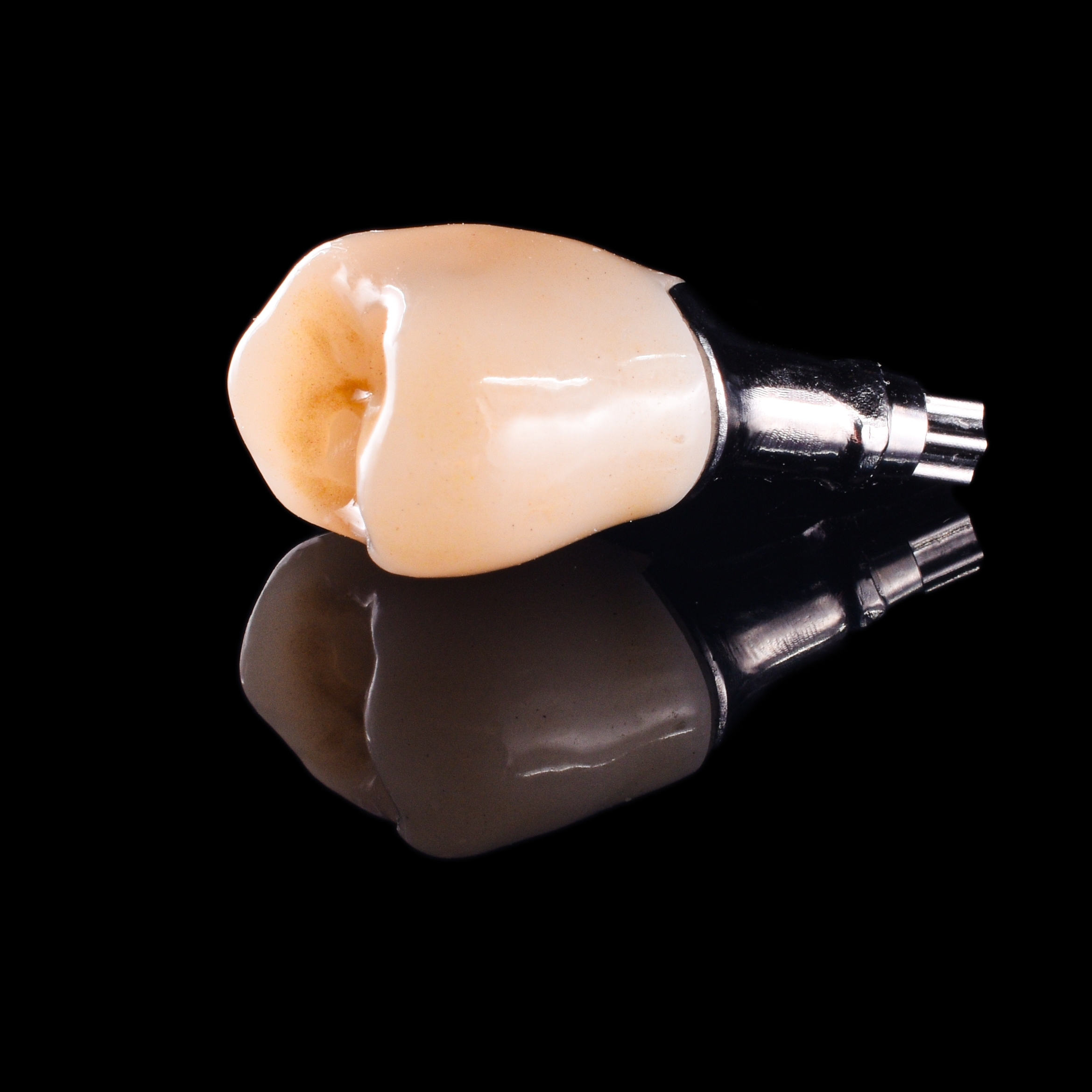 Custom implant abutment
