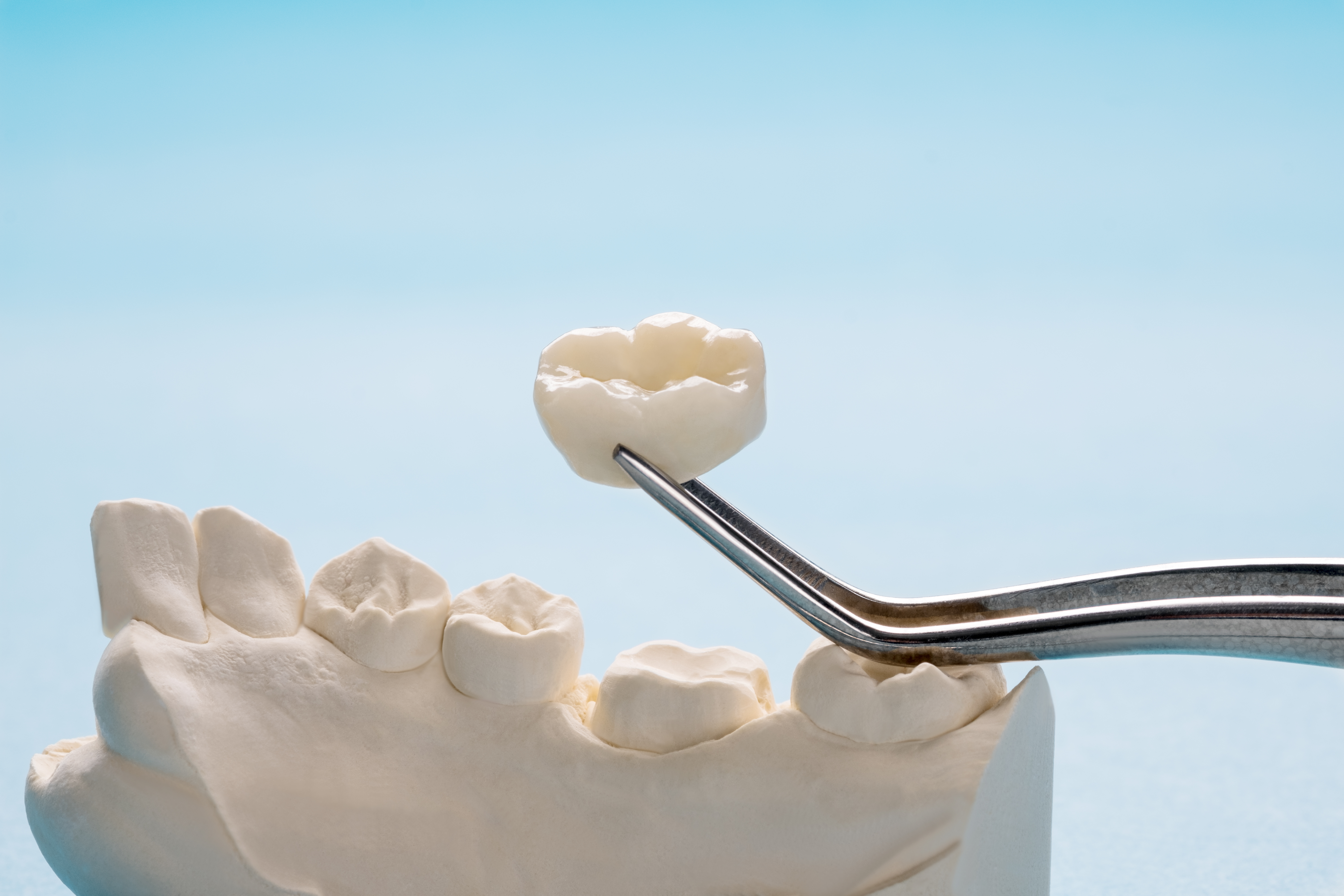 Zirconia Crowns