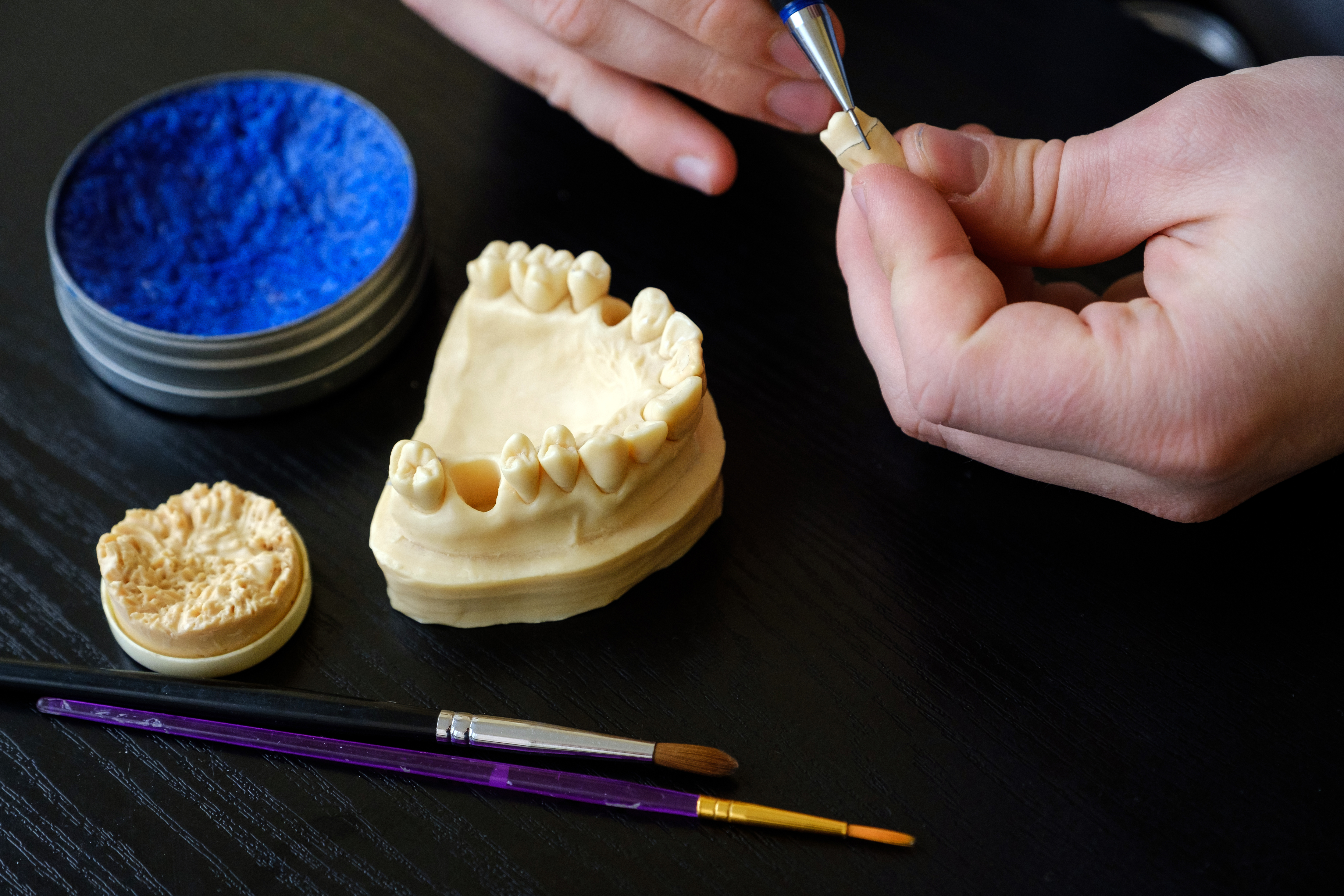 Diagnostic Wax-Ups